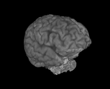 brain